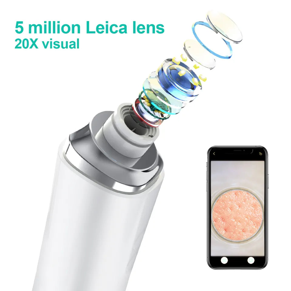 Gleime™ - Blackhead Pro Vacuum Device