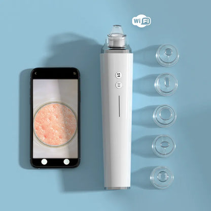 Gleime™ - Blackhead Pro Vacuum Device