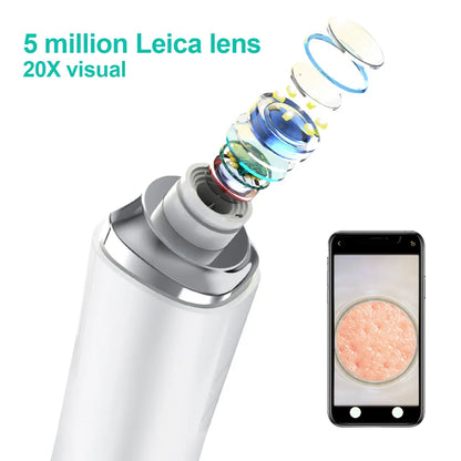 Gleime™ - Blackhead Pro Vacuum Device