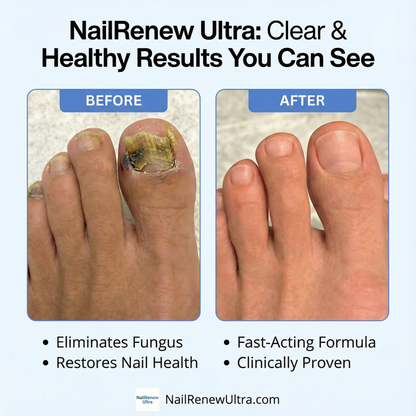 NailRenew Ultra