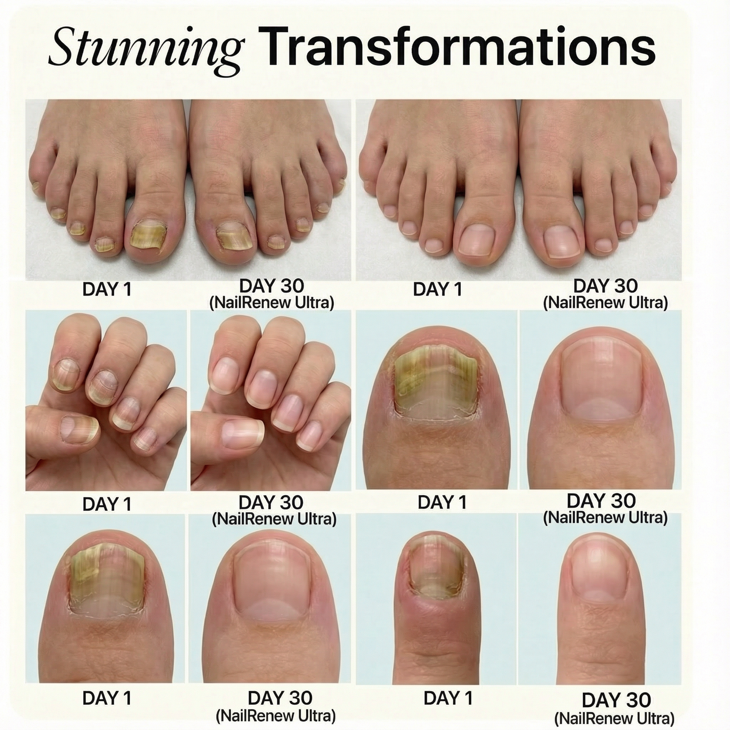 NailRenew Ultra