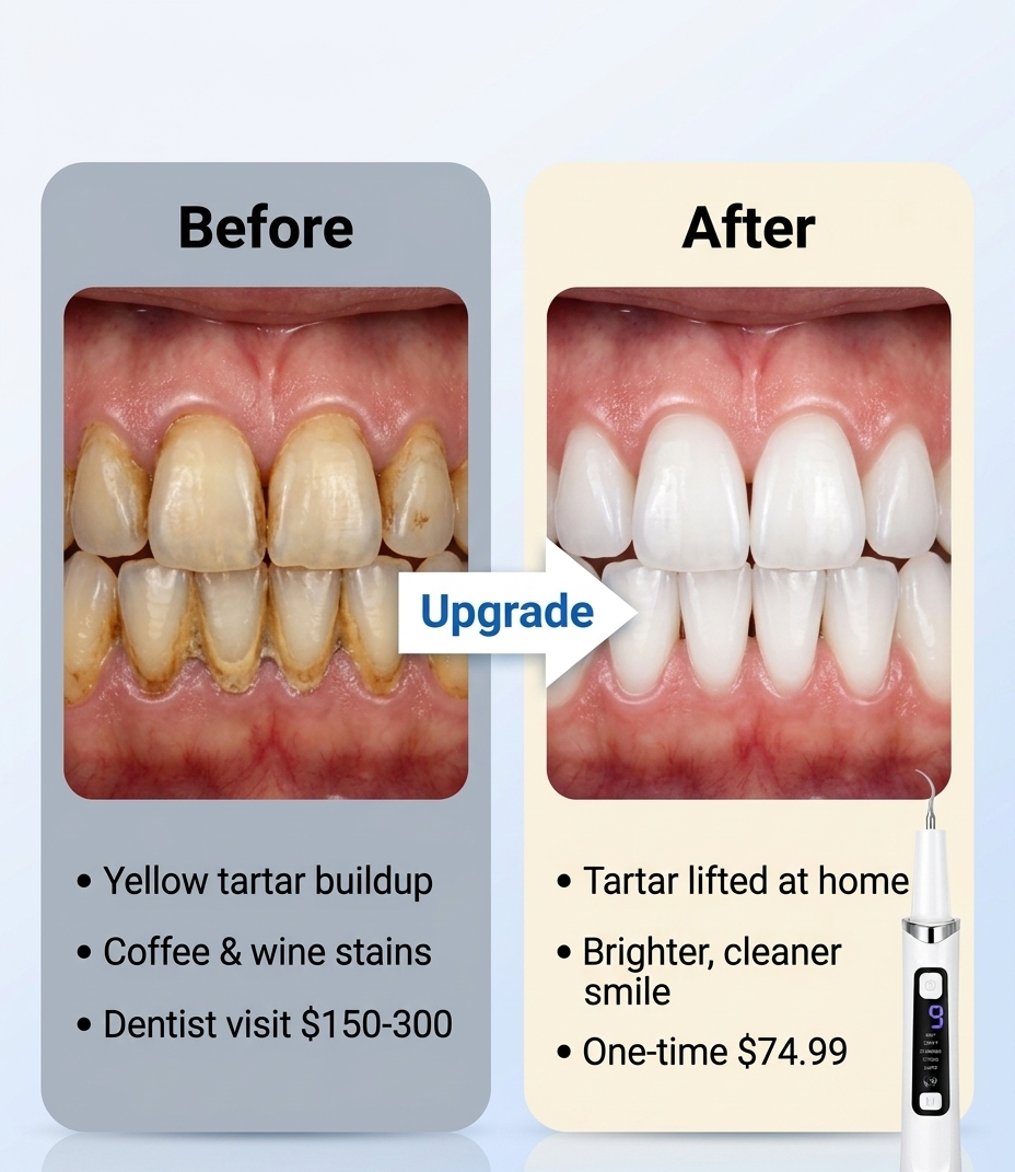 Before and after tartar removal